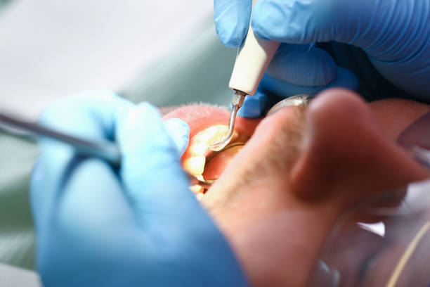 Best Weekend Emergency Dentist in Columbia, MS