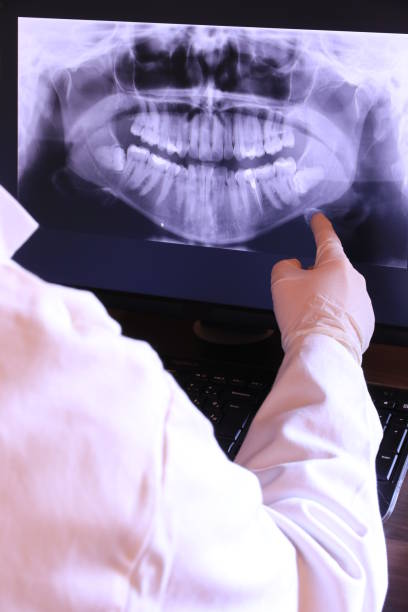 Best Emergency Wisdom Teeth Removal in Columbia, MS