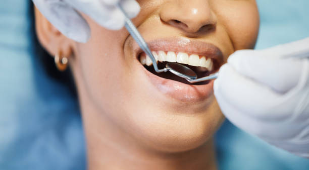 Best Same-Day Emergency Dental Services in Columbia, MS