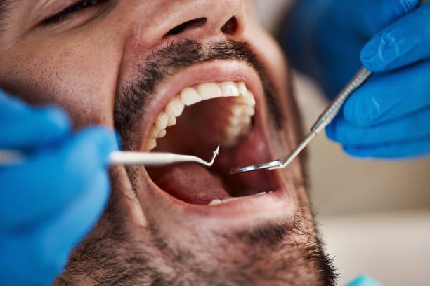 Best Urgent Care for Lost Fillings or Crowns in Columbia, MS